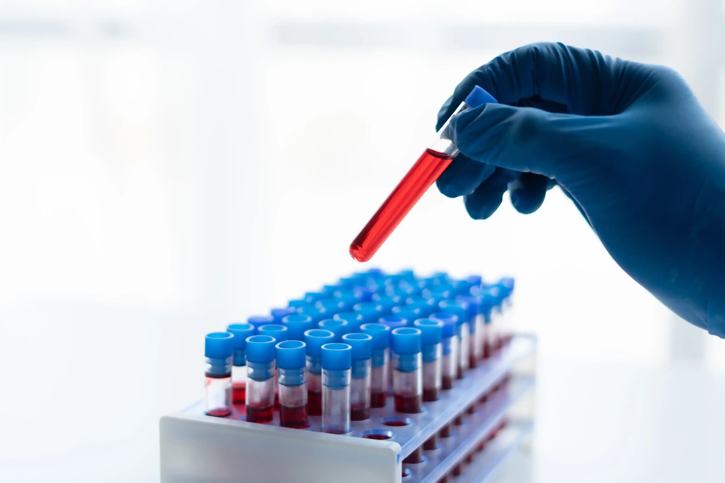 Blood Test Home Collection